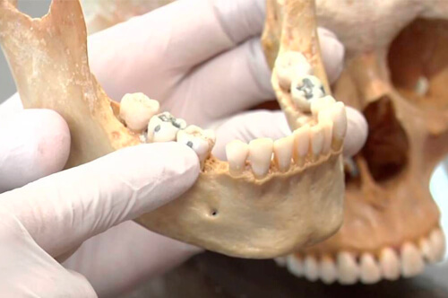 Odontologia Legal (Forense)